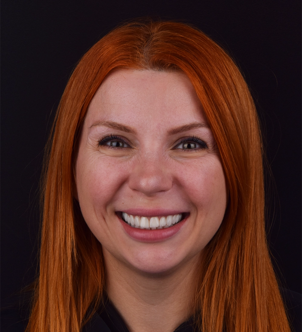 Orthodontic Treatments