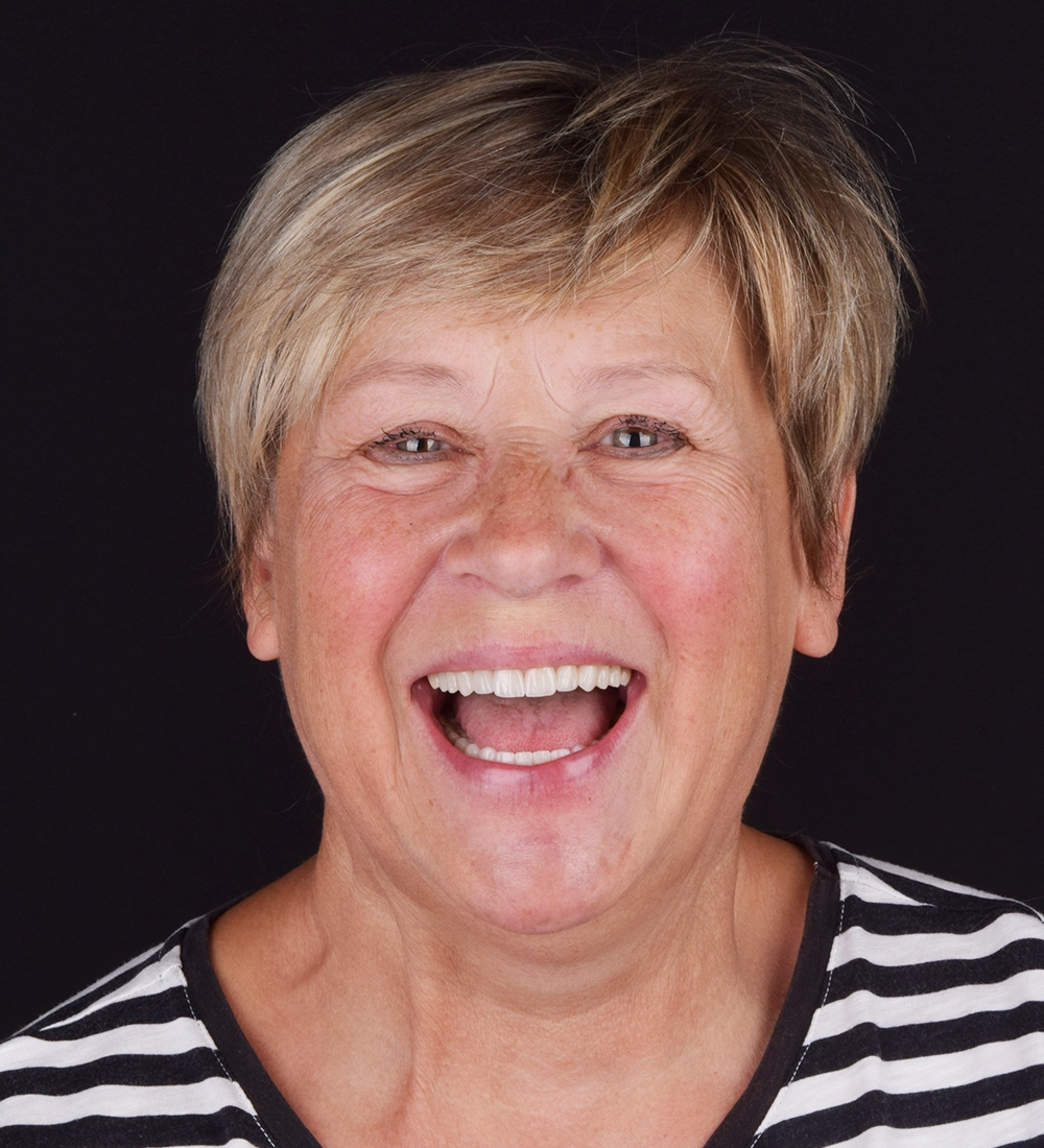 Periodontal Treatments